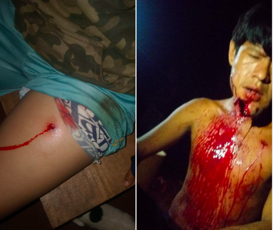 Povo Avá-Guarani sofre novos ataques no oeste do Paraná: quatro indígenas feridos