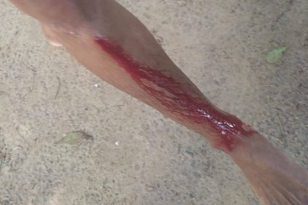 Indígena Parakanã é ferido a tiro em novo ataque à Terra Indígena Apyterewa