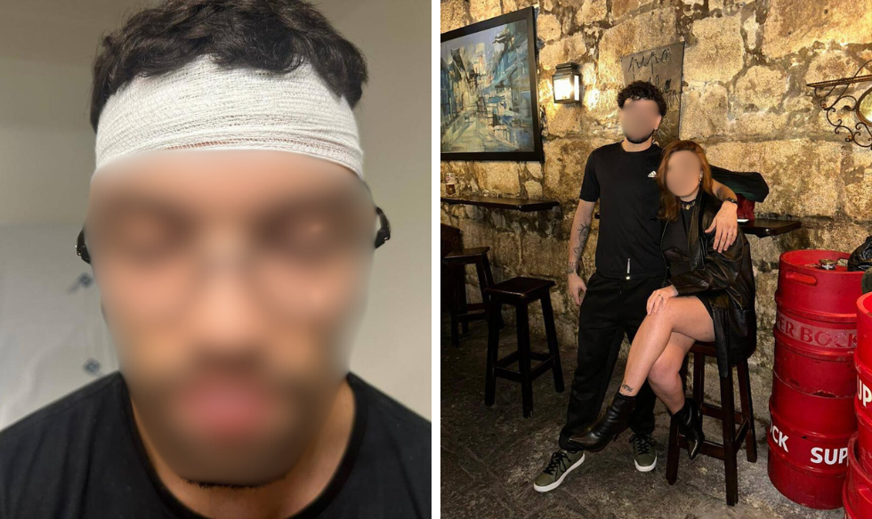 Brasileiro é agredido em Portugal com garrafadas na cabeça: ‘queremos justiça’